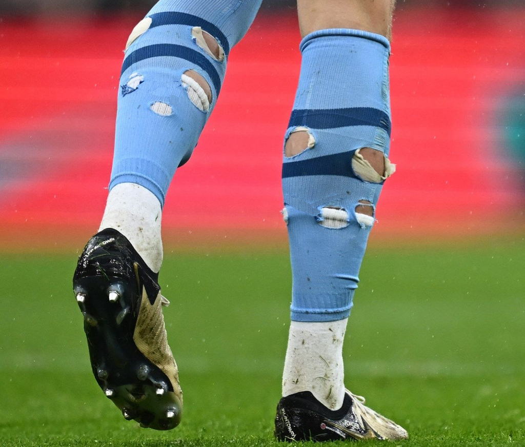The Great Sock Cutting Mystery Amongst Pro Soccer Players